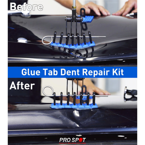 Pro Spot Glue Tab Dent Pulling System PRO-GTK – Glue Dent Kit